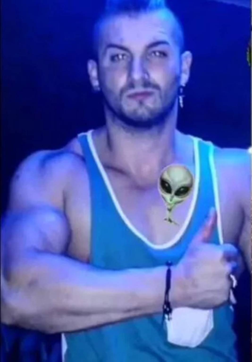 Siyah bir uzaylıya benzemek için kulaklarını, burnunu ve üst dudağını aldırdı! Bu fotoğrafları çocuklar görmesin! 4